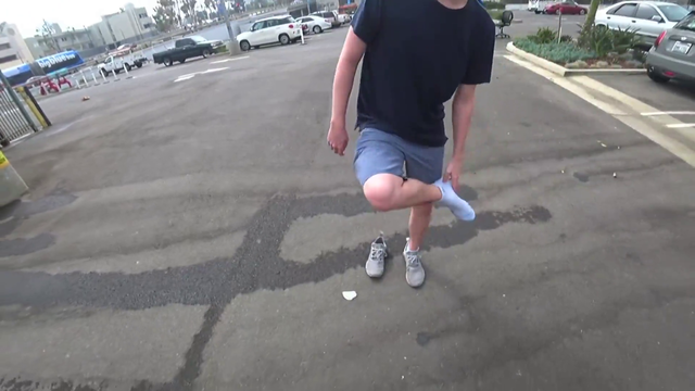 Chance shows his fucked up toe