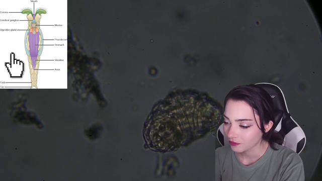 Microorganisms Fight on Microscope Stream!