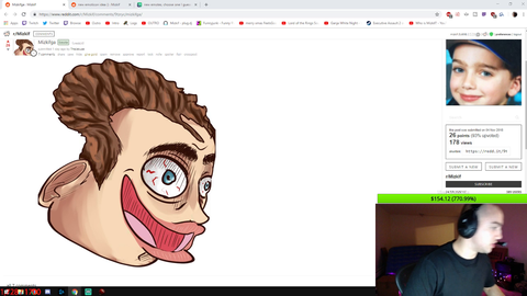 Mizkifs head dent