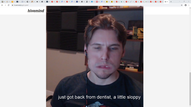 Jerma after a dentist visit