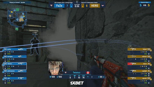 karrigans face recoil
