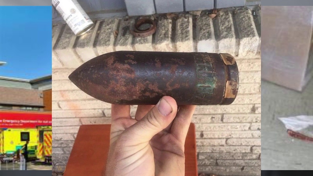 An army bomb squad was called to remove a WW2 artillery round from a mans asshole