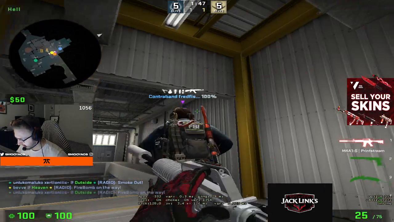 Smooya just broke his hand