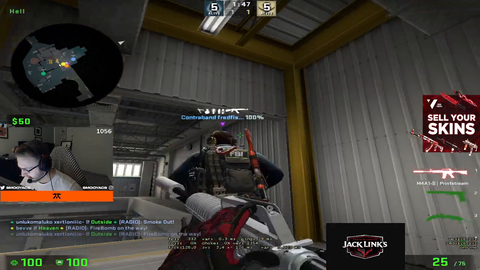Smooya just broke his hand