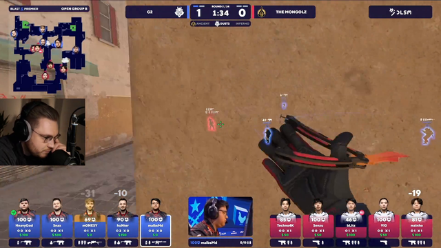 ohne has a normal reaction to a m0nesy shot