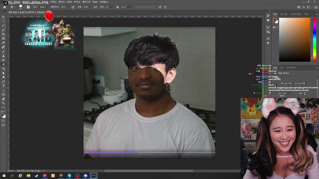 Lacari finally gets a hair transplant
