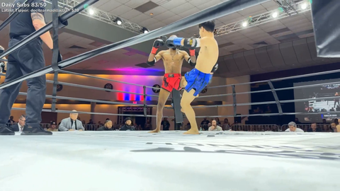(GRAPHIC) Ronnie’s leg snaps during fight