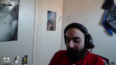 Slyker can not get a hair transplant cause he is too bald OMEGALUL