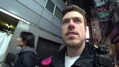 Jake's close call