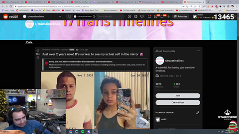 Macaiyla made it to the front page of a Trans subreddit after getting chin surgery