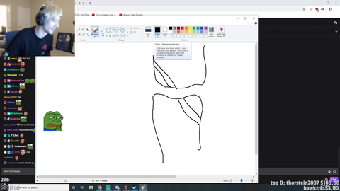 xQc explains the problem with his knee that had him in the emergency room yesterday